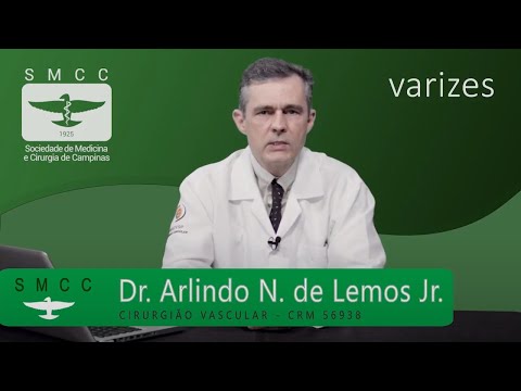DICAS DE SAÚDE SMCC: Varizes - sintomas, cuidados e tratamentos