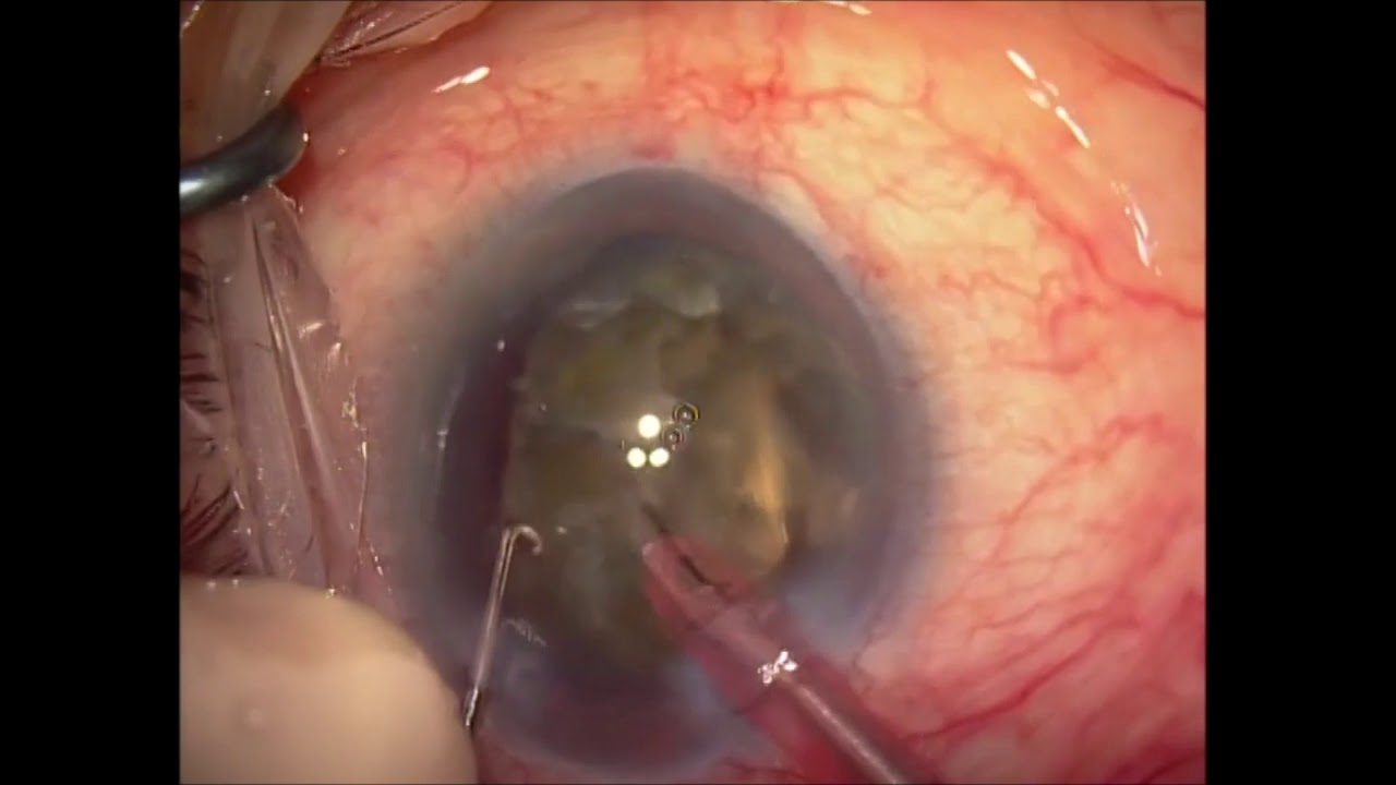 Miguel Angel Ibañez Hernandez-29