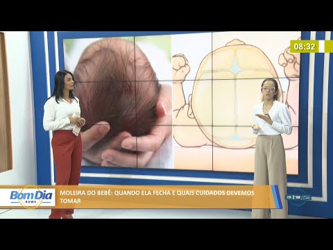 Fisioterapeuta explica quando a moleira de um bebê fecha e os cuidados necessários 14 01 2022