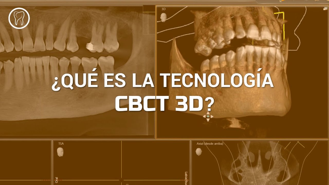 Walter Otárola Ramírez-11