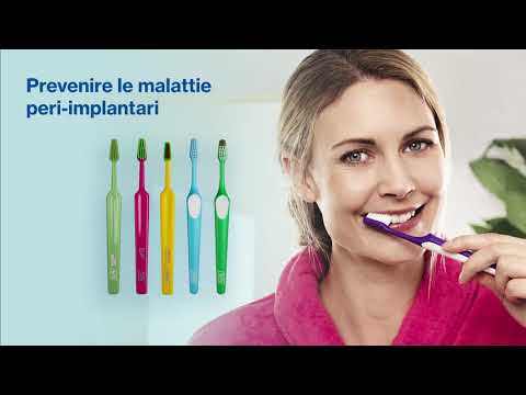 TePe Share Webinar – Cura degli impianti