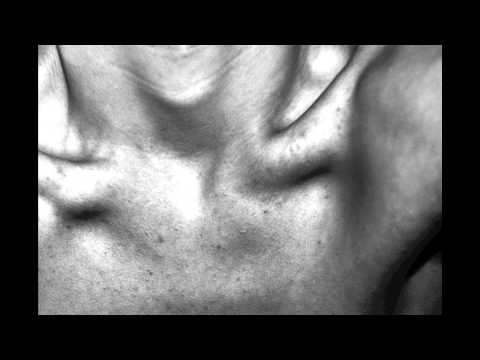 Hiperkarma - Amondó (columbo mix)