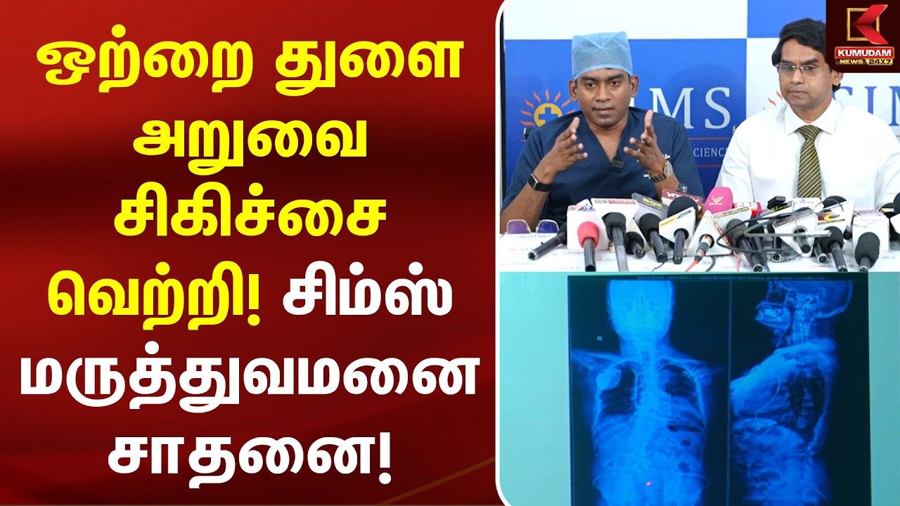 ஒற்றை துளை அறுவை சிகிச்சை வெற்றி! சிம்ஸ் மருத்துவமனை சாதனை! | SIMS Hospital | Chennai