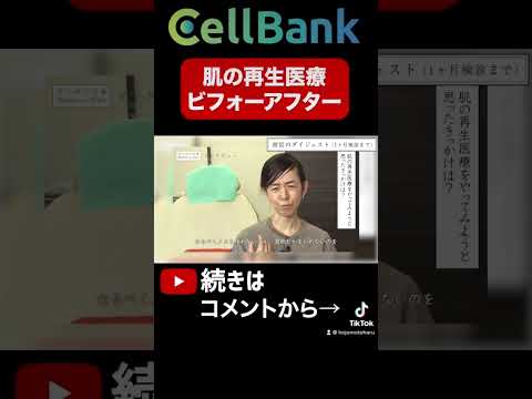 シワは消えましたか?一部のアンチエイジング方法はひどい結果に終わる可能性があります