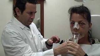 Facial Plastic Surgery: Recovery Day 4