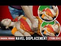 Chiropractic Adjustment In Mumbai Thane Navel Displacement Gas And Acidity Abdominal Pain