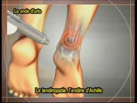 Male la gamba destra al basso ventre e inferiore della schiena Trattamento della gamba malattia rimedi articolazioni popolari