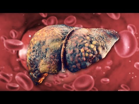Schmerzen im Unterleib auf die Rückseite einer Frau strahl Traditionelle Medizin gegen Osteoarthritis des Knies