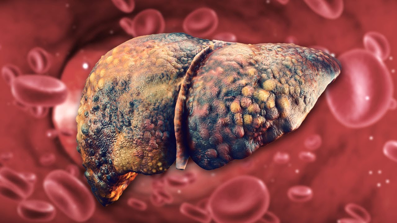 YouTube Video Thumbnail