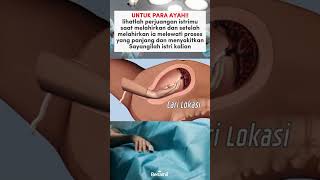 Download lagu Detik Perjuangan Ibu Melahirkan - Medikacare mp3