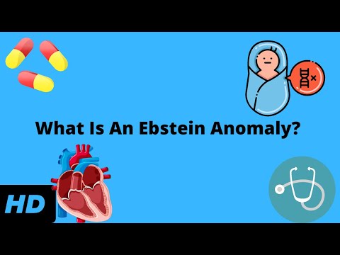 Myocardial Infarction Causes Signs and Symptoms Diagnosis and Treatment