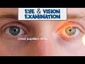 Examination of the Eyes and Vision - OSCE Guide (old version) | UKMLA | CPSA