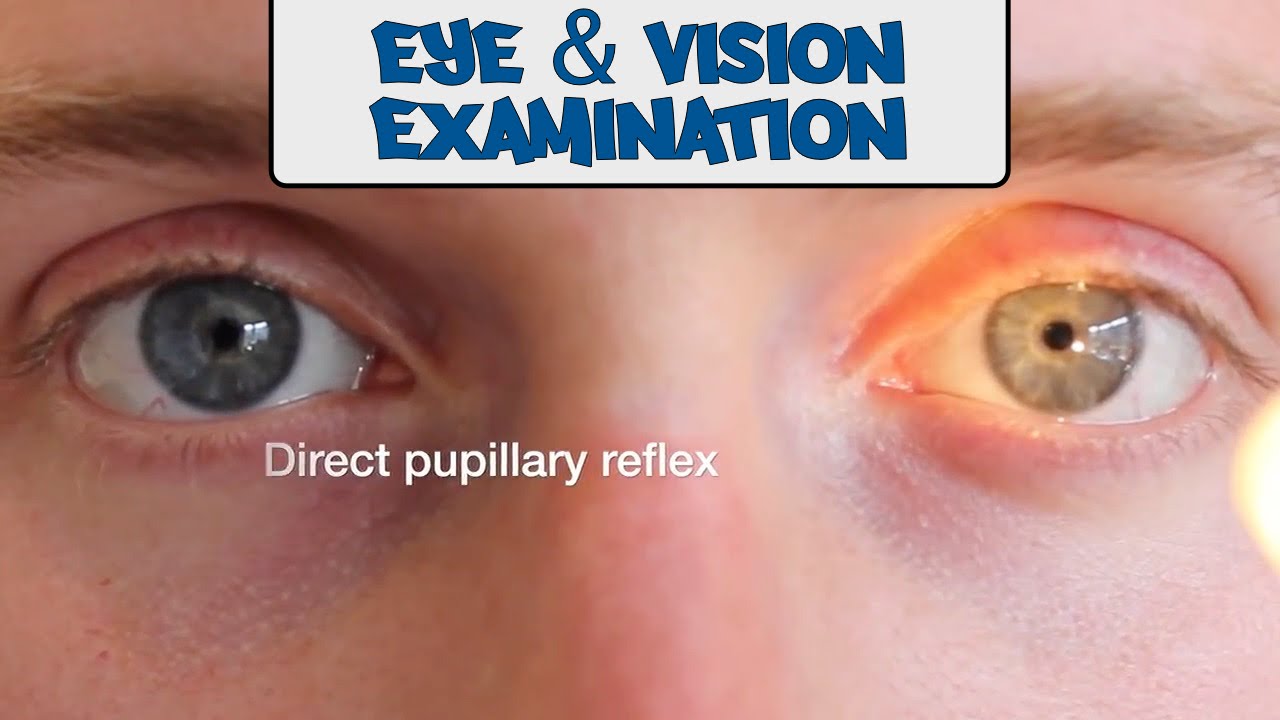 Examination of the Eyes and Vision - OSCE Guide (old version) | UKMLA | CPSA
