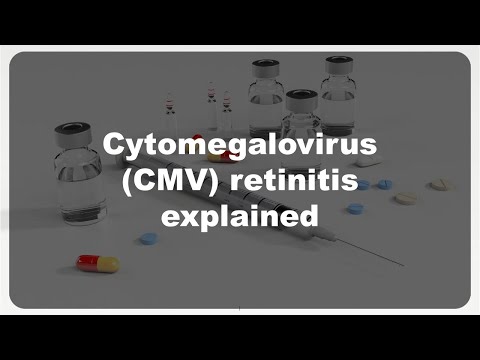 Cytomegalovirus (CMV) retinitis explained