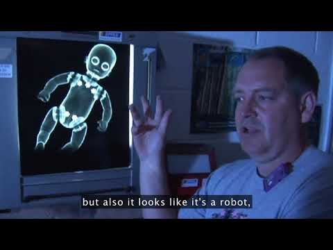 Imaging Tests: Unveiling the Invisible | Community Health