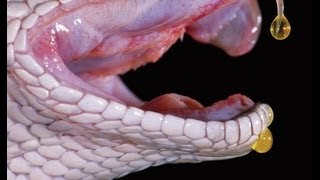 Check Out What Snake Venom Does To Human Blood. (MUST SEE)
