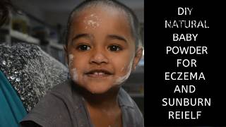 #DIY natural baby powder for eczema and sunburn relief