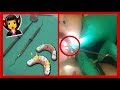 I GOT PERMANENT FANG IMPLANTS Bethany Wilhelm