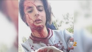 Teenager's Skull Fractured In After-School Attack Posted To Snapchat