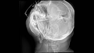 Dynamic Digital Radiology View of C Spine Fuchs Imaging