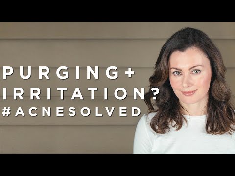 Purging & Irritation: How to Handle The Challenges #AcneSolved - Part 2 | Dr Sam Bunting
