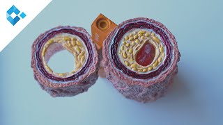 Gefäßverschluss am Herzen: Risikofaktoren, Prävention & Behandlung | Univ.-Prof.