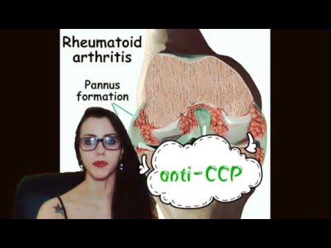 Temporo comune disfunzione ICD Si presenta come un osteocondrosi cervicale
