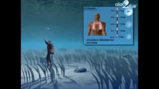 Why not to hold your breath while scuba dive