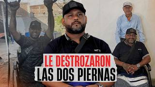“Su hijo se va a morir”: una pipa le pasó por encima y perdió ambas piernas