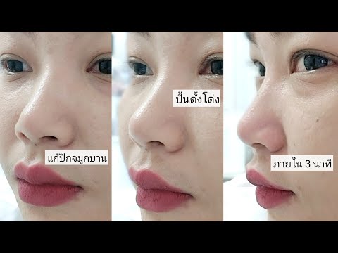 โบท็อก ปีกจมูก