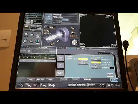 Toshiba Tc de Abdômen