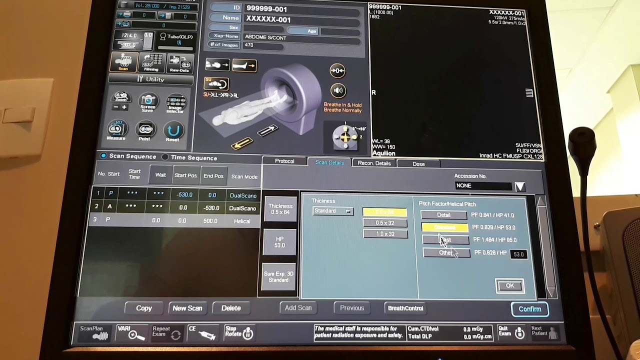 Toshiba Tc de Abdômen