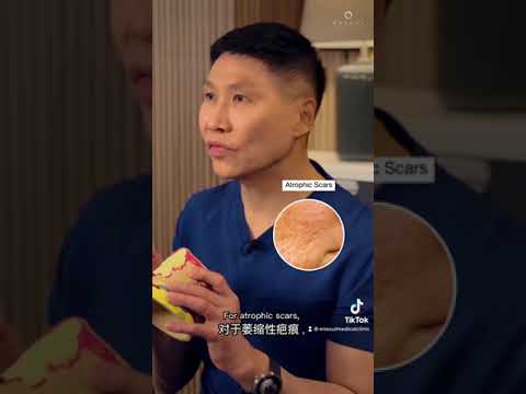 Dr Kenneth Thean | How Do We Treat Acne Scars Part 2