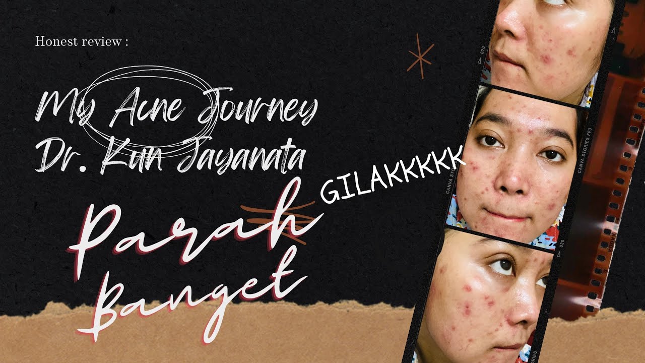 Review Dr. Kun Jayanata 1 Bulan | Parah banget