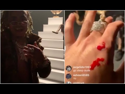 Venomous Snake Bites Lil Pump At At El Alfa El Jefe Coranado Video Shoot