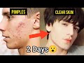 How To Get Clear Skin Just In 2 Days