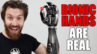 This Bionic Hand Will Change Everything!