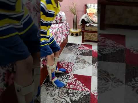 Leg ankle foot orthosis afo