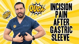 Incision Pain After Gastric Sleeve | Vertical Sleeve Gastrectomy | Questions and Answers