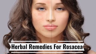 The Best Herbal Remedies For Rosacea And Intolerable Redness - Easy Natural Remedies