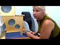 Fysiotherapie biedt redding voor gedumpte kitten Arie