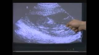 A Silent Scream (Short Clip)