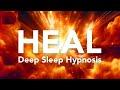 Hypnosis For Deep Sleep Activating Self Healing For Body Mind And Spirit Very Strong