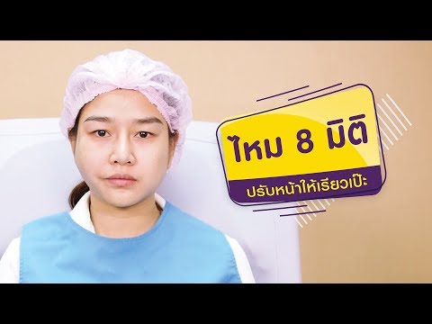 ร้อยไหม หน้าเรียว