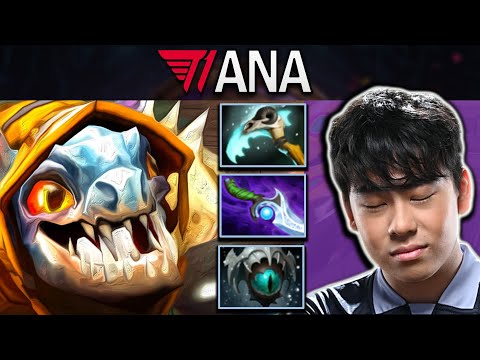 Slark Dota 2 Gameplay T1.Ana tries Scythe of Vyse and Diffusal Combo - TI12