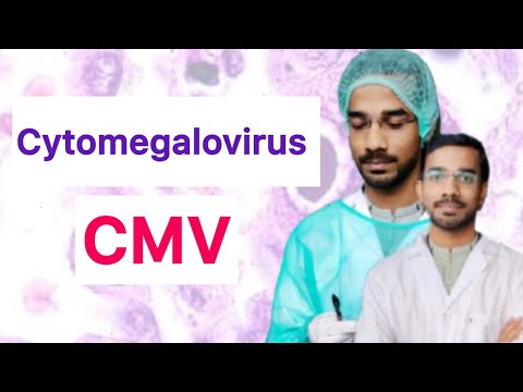 Cytomegalovirus (CMV) | Transmission | Manifestation | Diagnosis | Treatment