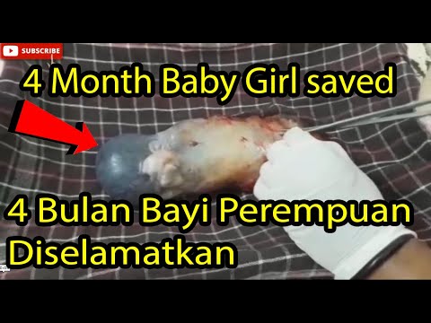 4 MONTH NEW BORN BABY GIRL RESCUED | UTV