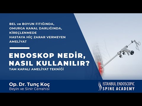 Endoskop Nedir, Nasıl Kullanılır?