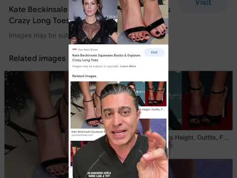 Kate Beckinsale Foot Condition!