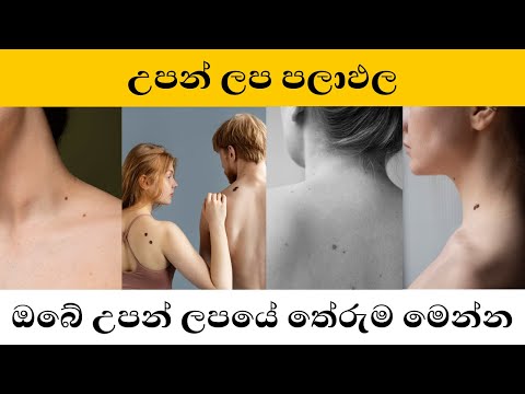 උපන් ලප පලාඵල | Upan lapa palapala | උපන් ලප පිහිටීම අනුව චරිත ලක්ෂණ, අනාවැකි  | Birth mark Sinhala